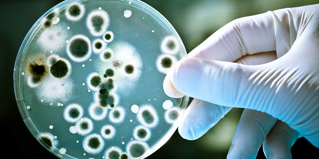If you were bacteria, you'd be the good kind.